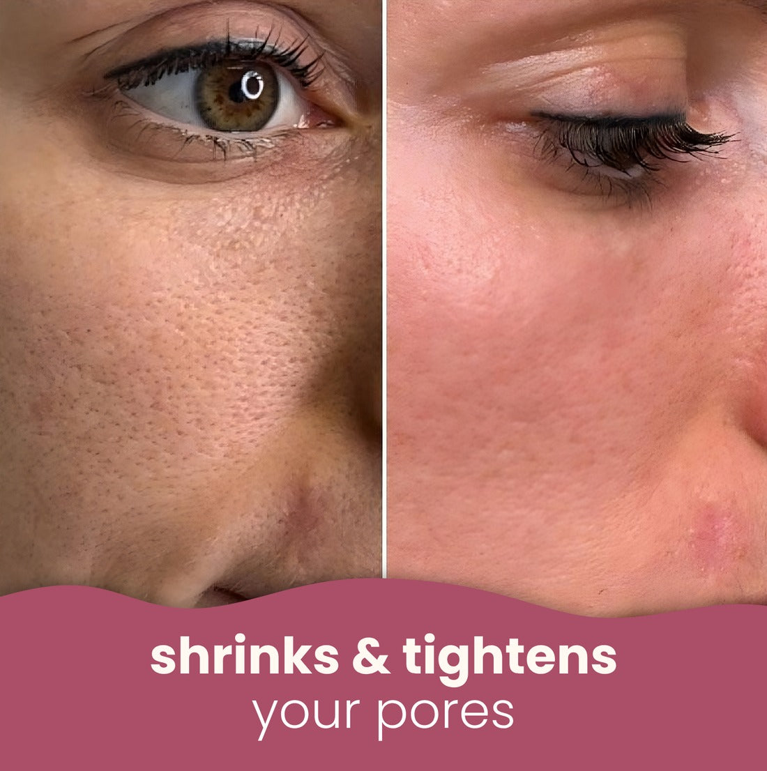 Soloria™ Brightening Turmeric & Kojic Acid Pads (30 Pads)