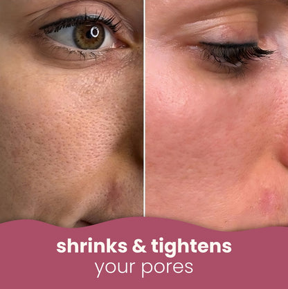 Soloria™ Brightening Turmeric & Kojic Acid Pads (30 Pads)