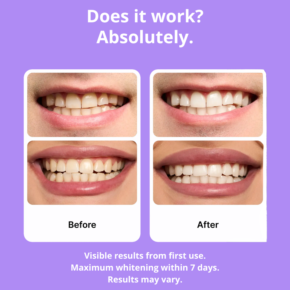 Glowbite™ Teeth Whitening Strips