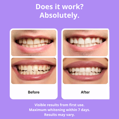 Glowbite™ Teeth Whitening Strips