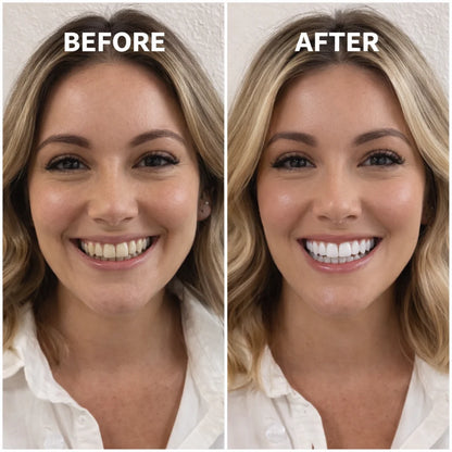 Glowbite™ Teeth Whitening Strips