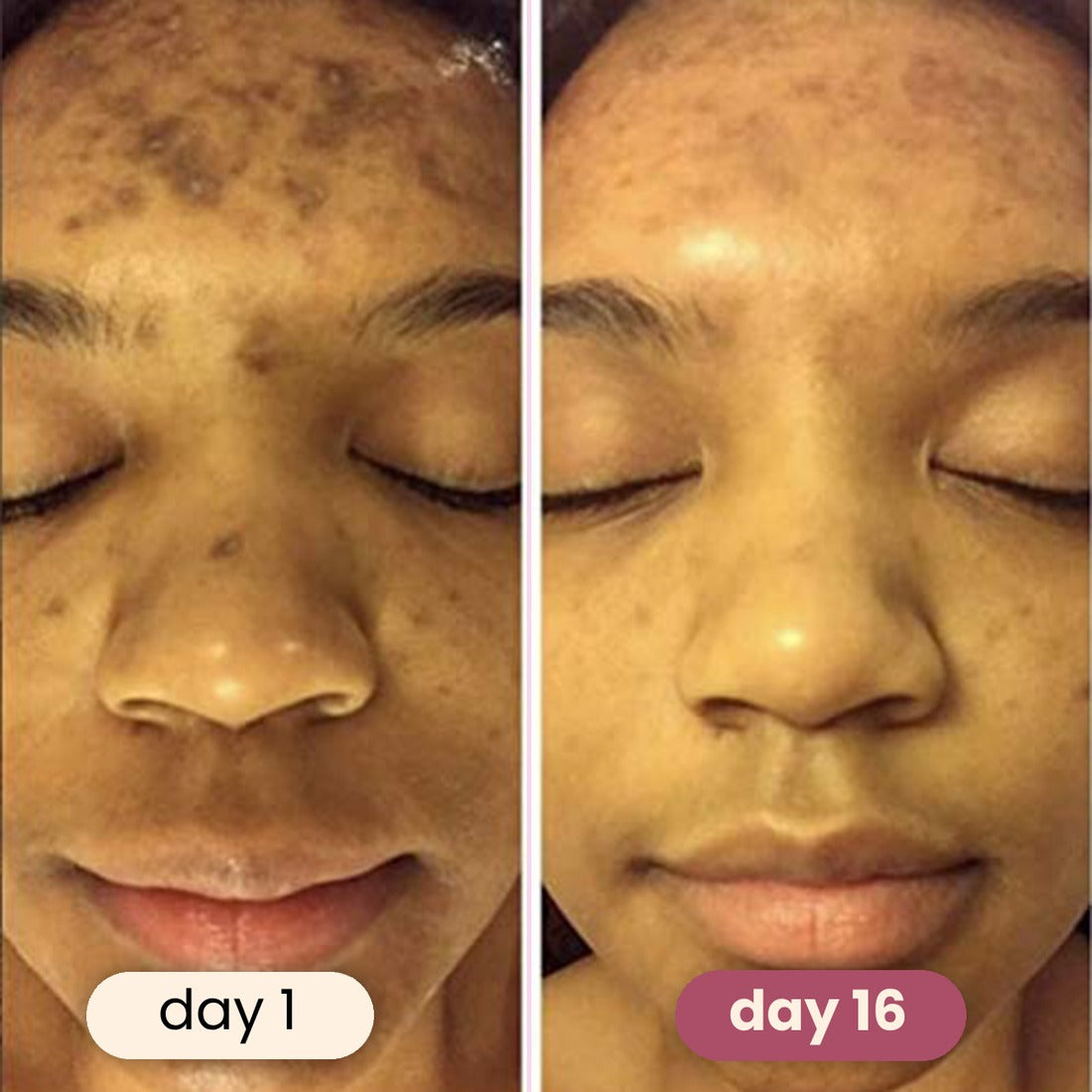 Soloria™ Brightening Turmeric & Kojic Acid Pads (30 Pads)