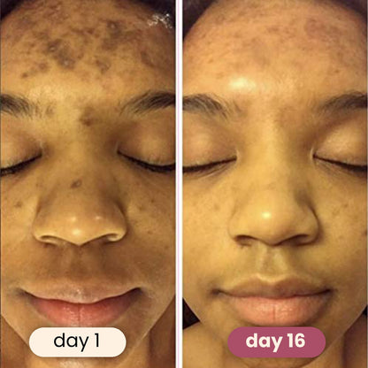 Soloria™ Brightening Turmeric & Kojic Acid Pads (30 Pads)