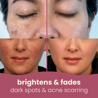 Soloria™ Brightening Turmeric & Kojic Acid Pads (30 Pads)
